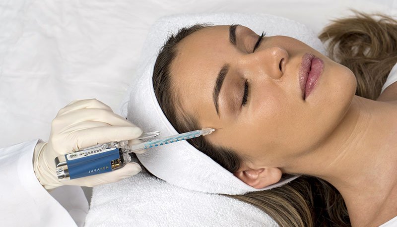 Juvapern après injection de Botox à Paris - Dr Benachour